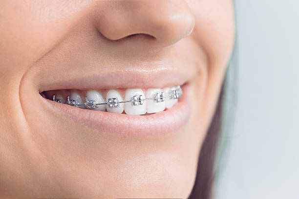 Best Veneers and Lumineers  in Prairie Du Chien, WI